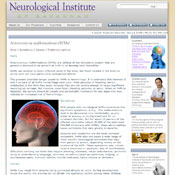 Arteriovenous         malformations (AVMs)