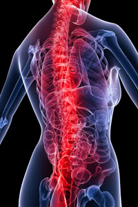 Spinal Cord Stimulators vs. Intrathecal Pumps for Chronic Back Pain