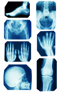 body parts xray